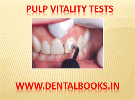 Pulp Vitality Tests Notes And Ppt For Final And Neet Exam