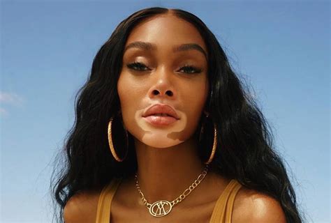 Model Winnie Harlow Launches Sunscreen Inspired By Her Jamaican Heritage