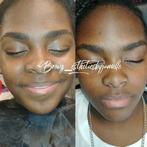 Unibrow Before And After