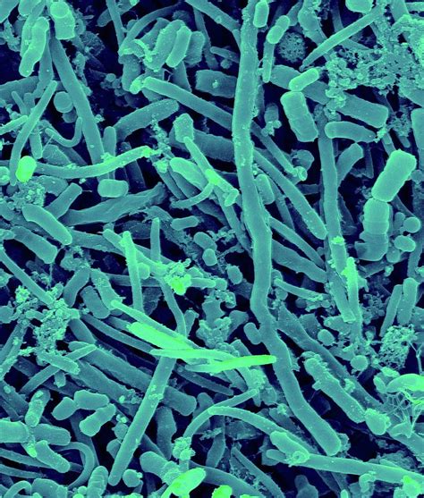 Human Oral Bacteria Photograph By Dennis Kunkel Microscopyscience