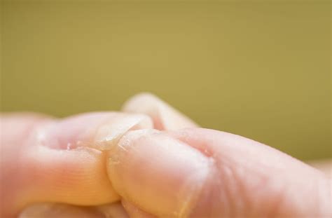 10 Health Warnings Your Nails May Be Sending You