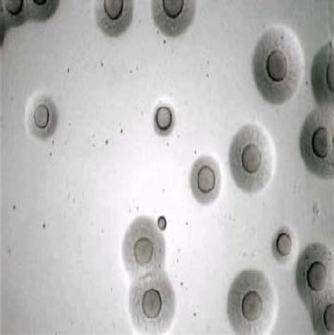 Microscopic Image Of Mycoplasma Bovis Colonies As Fried Eggs Appearance