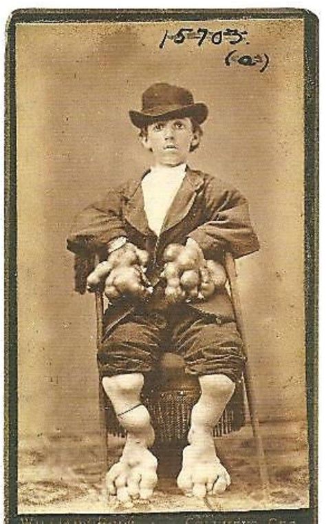 Circus Freaks Of The Past Old Circus Vintage Circus Circus Acts