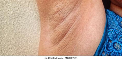 Skin Under Arms Women Has Wrinkles Stock Photo Edit Now 2100289531