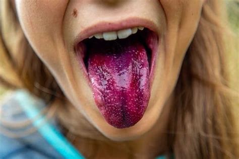 Know What Your Tongue Shape Says About You