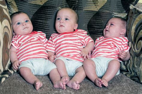 Meet The One In Two Million Triplets Where Twins Share Same Amniotic Sack And Placenta Mirror