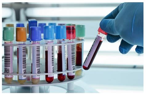 Blood Specimen Collection Processing Importance Procedure