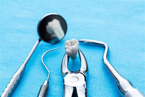 Cid Extração De Dentes
