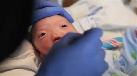 Miracle Baby Born Without Nose Dies