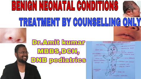 Benign Neonatal Conditions Learn Easily Minor Developmental
