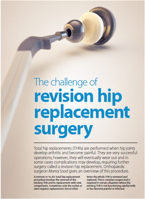 Revision Hip Surgery Hip And Knee Surgery