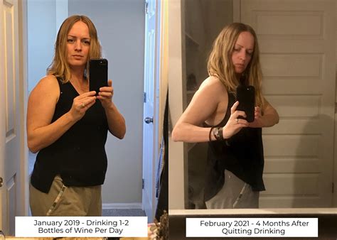 Before And After Alcohol Sobertown Podcast Sobriety Podcast