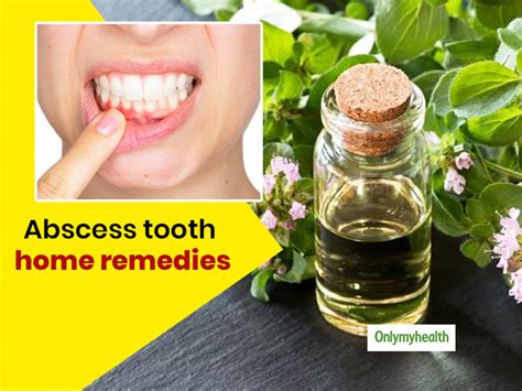 Abscessed Tooth Here Are 8 Useful Home Remedies To Get Rid Of It