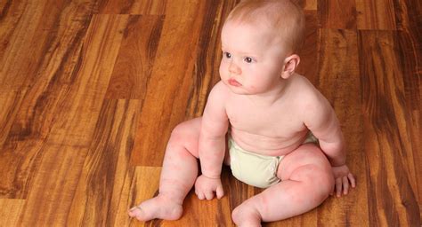 Hives In Babies Babycenter