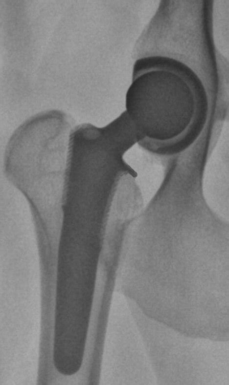 Outcomes For Total Joint Replacement In Dogs And Cats Texvetpets