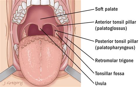 Tonsillectomy Anatomy