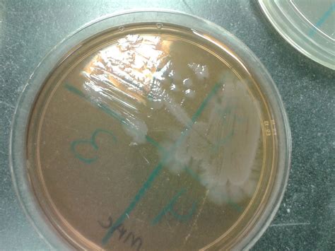 Microbiology Ejournal Day 17 Started Unknownsstreaked 2 Tsa1mac1pea