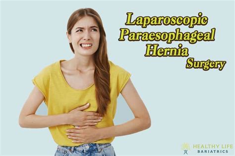 Paraesophageal Hernia Surgery Healthy Life Bariatrics