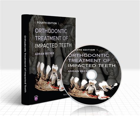 Orthodontic Treatment Of Impacted Teeth 4th Edition Companion Site Dvd