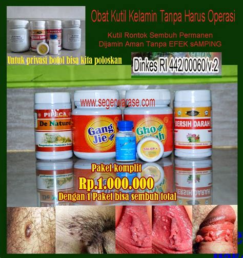 Oleh dosensosiologi.comdiposting pada 6 mei 20186 mei 2018. Contoh Gambar Penyakit Kutil Kelamin Pada Wanita