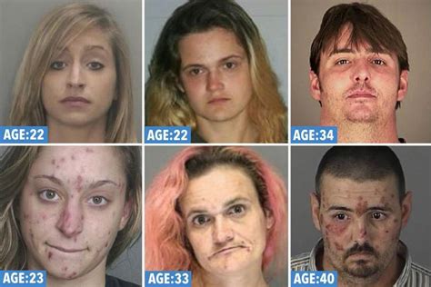 Shocking Pictures Of Addicts Ravaged Faces Reveal The Horrific