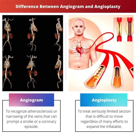Angiogram Vs Angioplasty Difference And Comparison