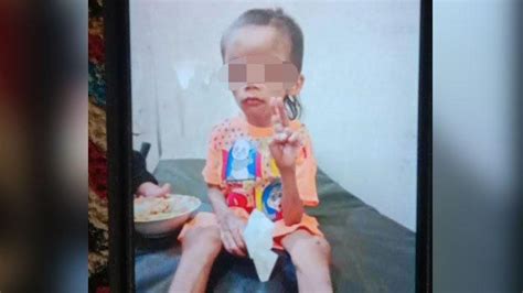 Update Bocah 7 Tahun Korban Penganiayaan Di Kota Malang Didampingi