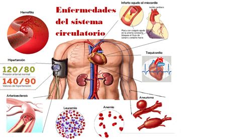 El Sistema Circulatorio Enfermedades Del Aparato Circulatorio Porn Sex Picture