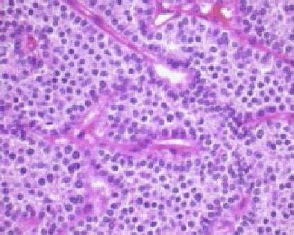 Erythropoietin stimulates the production of erythrocytes in response to hypoxia. Chief cell or principal cell. | Download Scientific Diagram