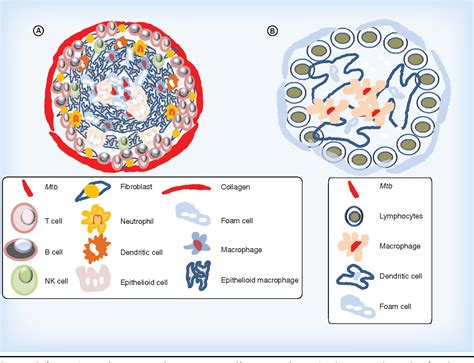 Granulomas represent a pathological hallmark of tb. Figure 4 from CONTENTS REVIEW : Understanding the ...