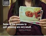 Pictures of Effects Of Smoking Marijuana While Pregnant
