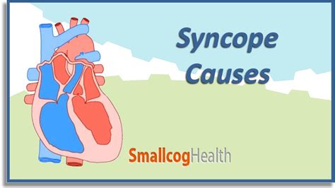 Syncope Causes Youtube