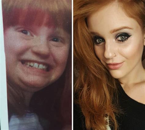 Transformations From Ugly Duckling Are Always Impressive 40 Pics