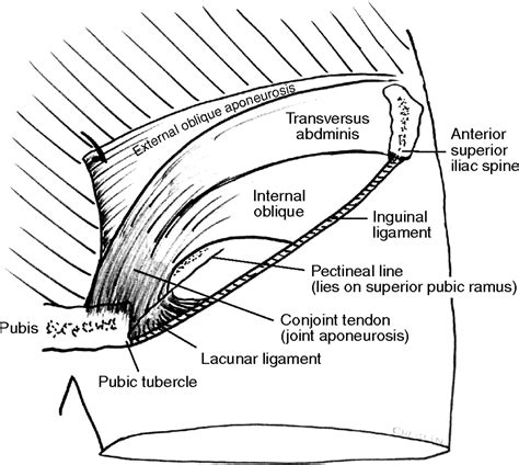 Conjoint Tendon Inguinal Canal