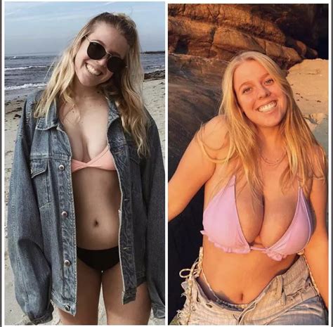 Lexi Snyder Before And After Massive Blow Up Nudes