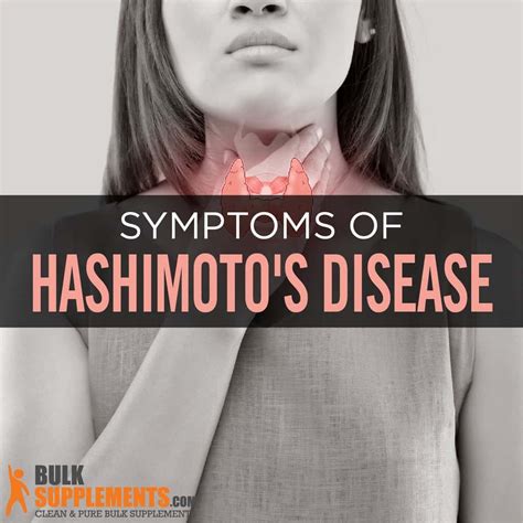 Hashimotos Disease Symptoms Causes And Treatment