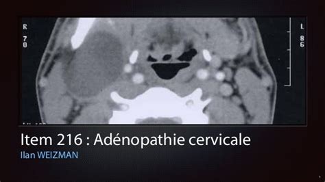 Adénopathie Cervicale
