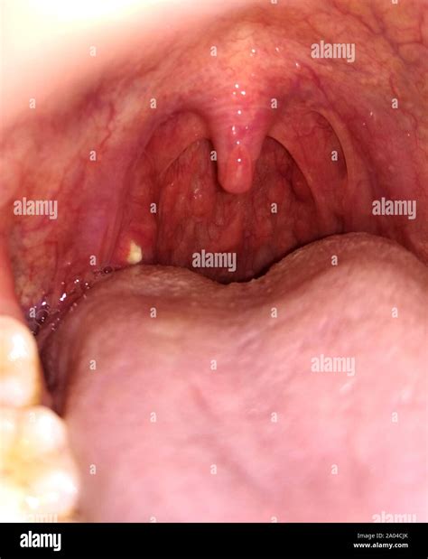 Human Mouth Diagram High Resolution Stock Photography And Images Alamy
