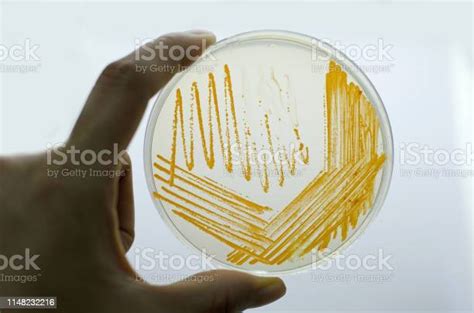 Orange Colonies Of Actinomyces Bacteria On Agar Plate Stock Photo