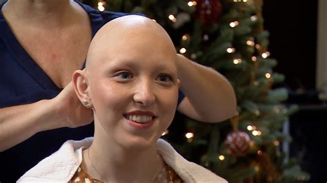 Woman With Alopecia Wouldnt Change Her Identity Bbc News