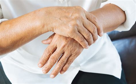 Uma Em Cada Cem Pessoas S O Acometidas Pela Artrite Reumatoide Creb