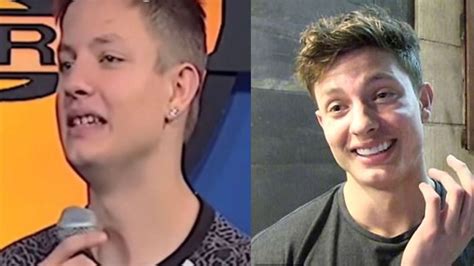 Matt Rife Before Fixing His Teeth The Wild ‘n Out Stars Glow Up Examined