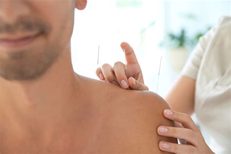 dry needling and medical acupuncture jill mclaggan
