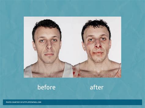 Before After Photo Courtesy Of