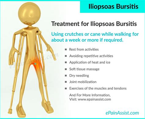 Iliopsoas Bursitis Or Iliopectineal Bursitiscausessymptomstreatment