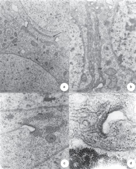 Tem Image Of Intercellular Bridges Between Cystocytes In Amellifera