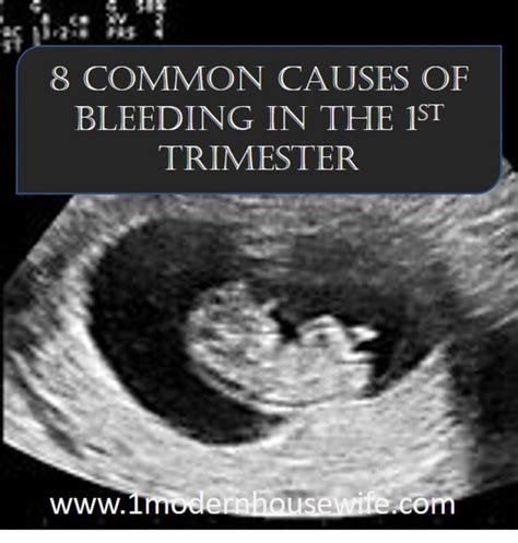Is It Normal To Have Heavy Bleeding During Pregnancy Pregnancywalls
