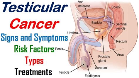 Testicular Cancer Signs Symptoms Risk Factors Types And Treatments