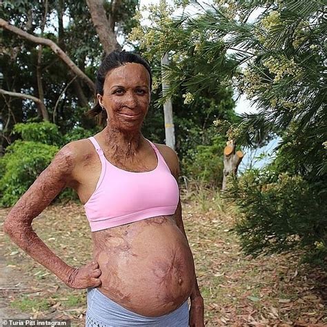 Turia Pitt And Fiance Michael Hoskin Celebrate Their Son Hakavai S First Birthday Daily Mail