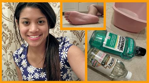 Diy Dry Foot Remedy Review Youtube